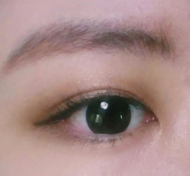 콩꾸물