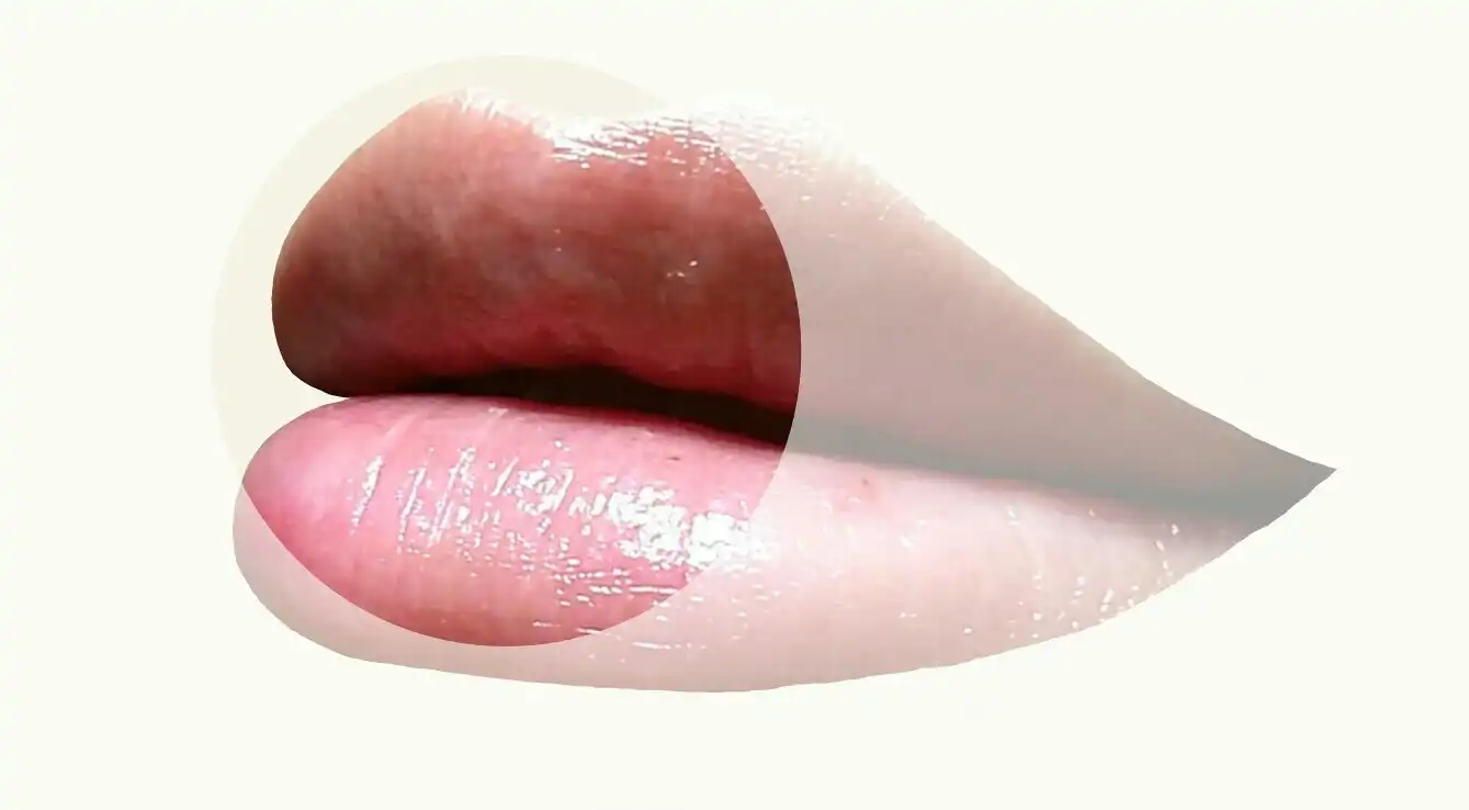 토탈 하이드레이션 3 in 1 립 테라피 [스윗 피치]