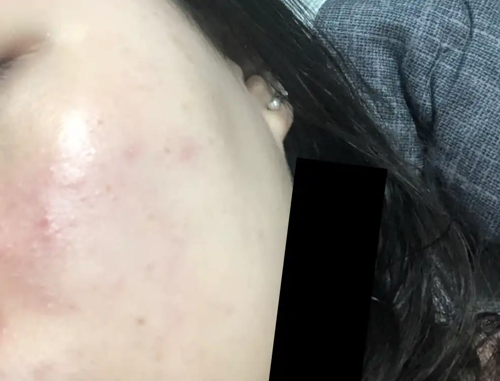 언니의파우치 리뷰 이미지 7 - [산뽕나무 잡티 크림]