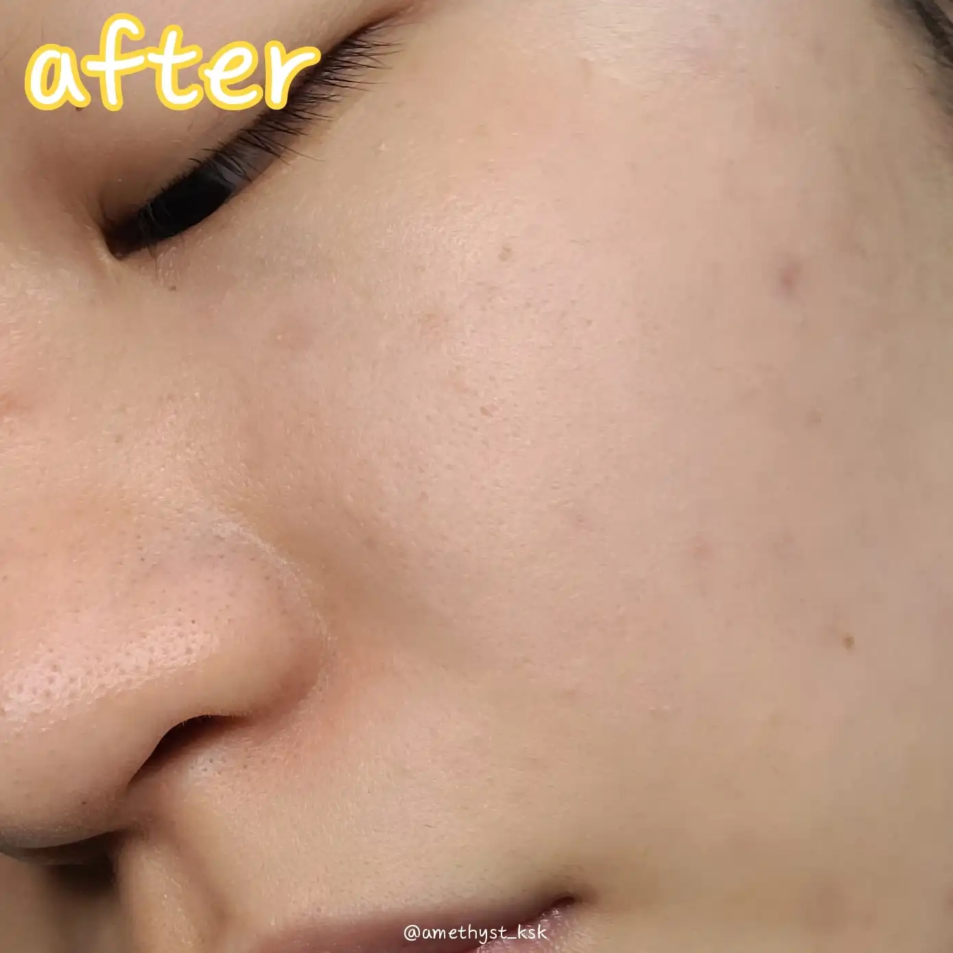 언니의파우치 리뷰 이미지 8 - [세라마이딘 엑토인 인퓨즈드 크림]