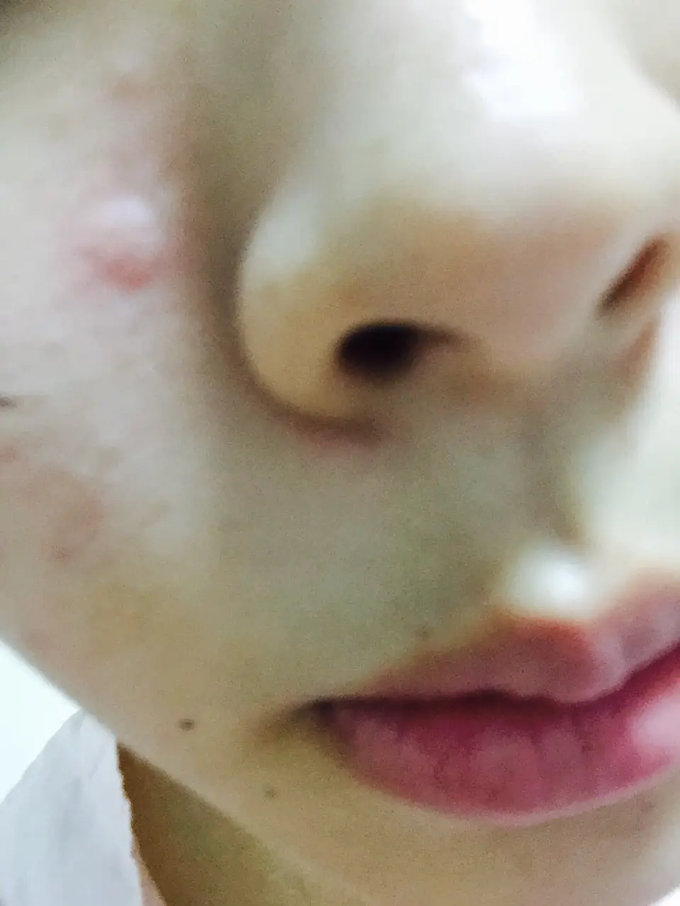 선택된 언니의파우치 리뷰 이미지 - [화산송이 블랙헤드 아웃밤]