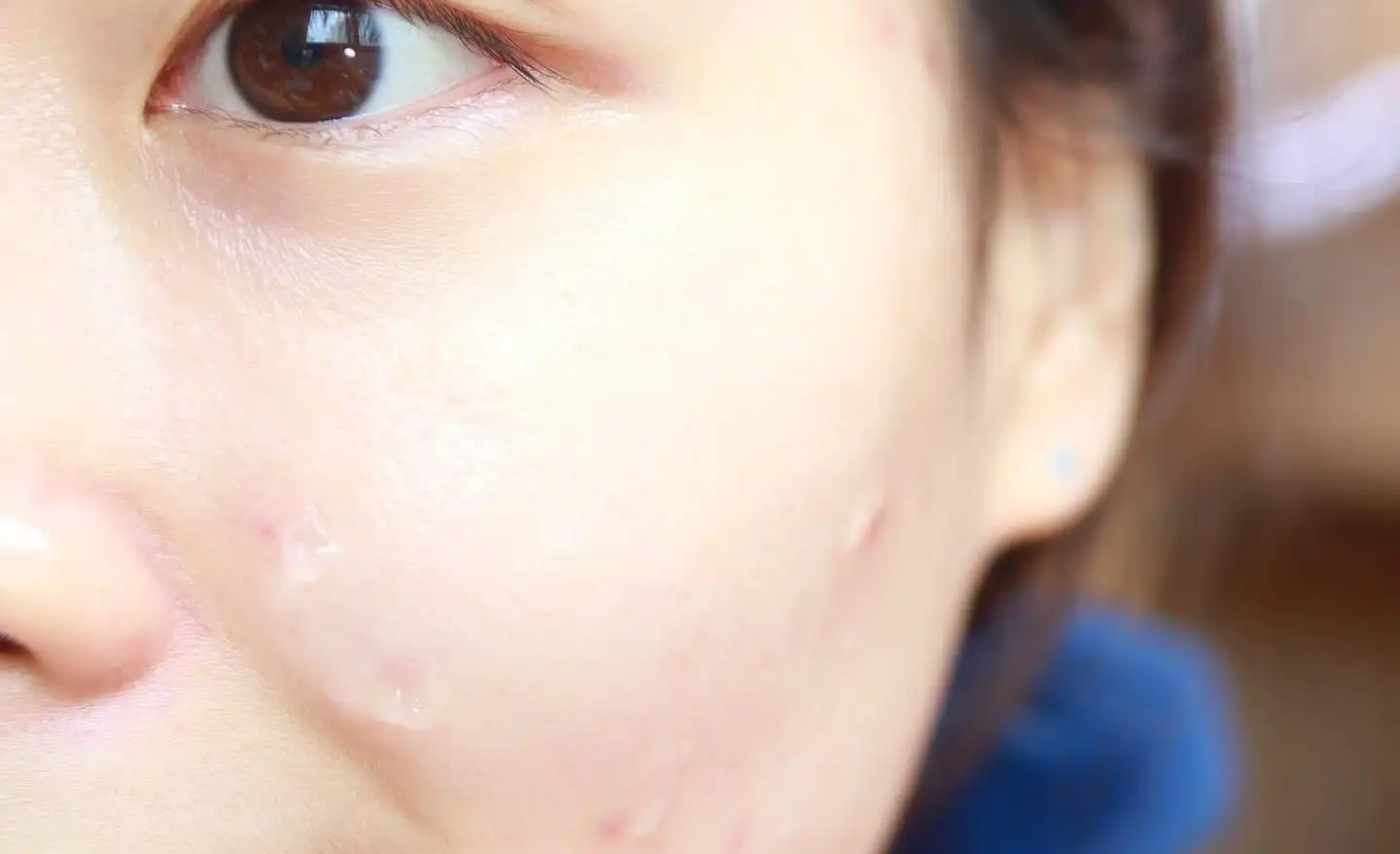 그린더마 티트리시카 스팟세럼