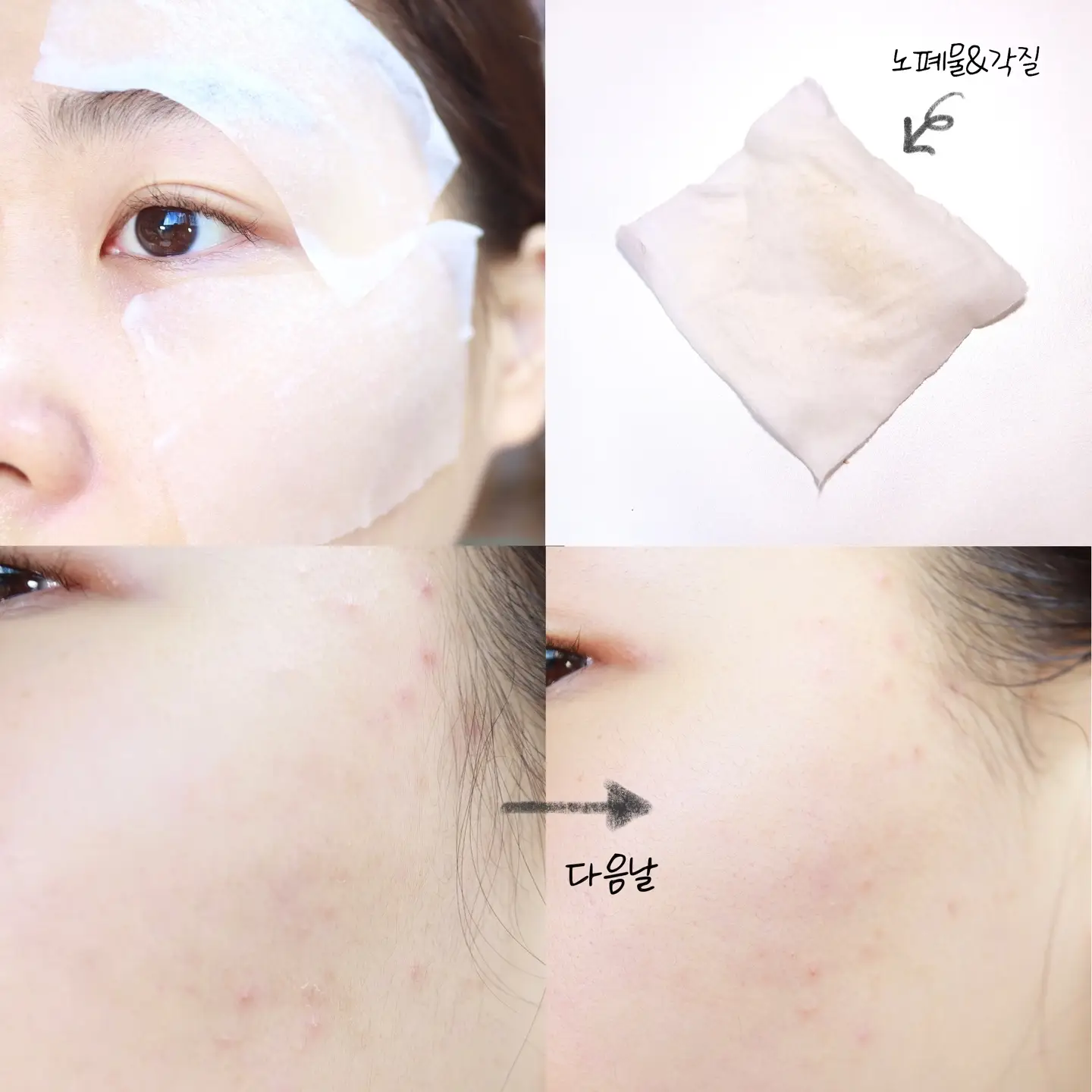 선택된 언니의파우치 리뷰 이미지 - [그린더마 티트리시카 토너]