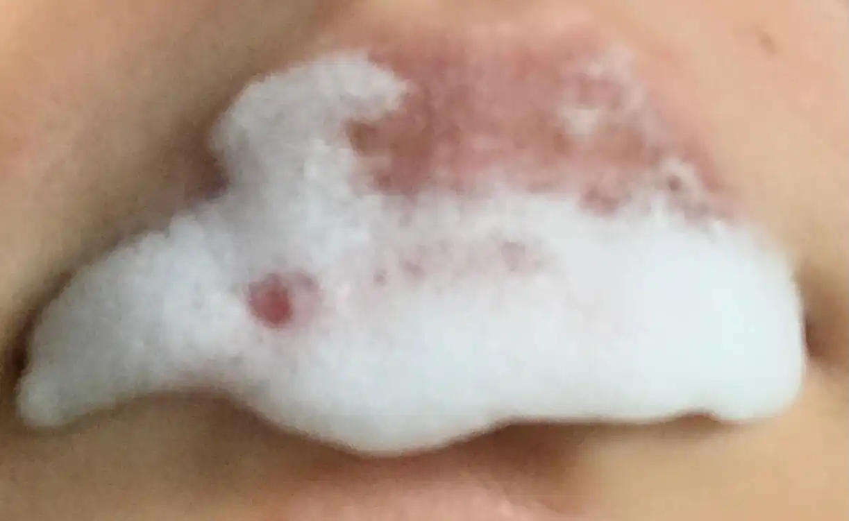 언파 부비부비 버블 립 스크럽