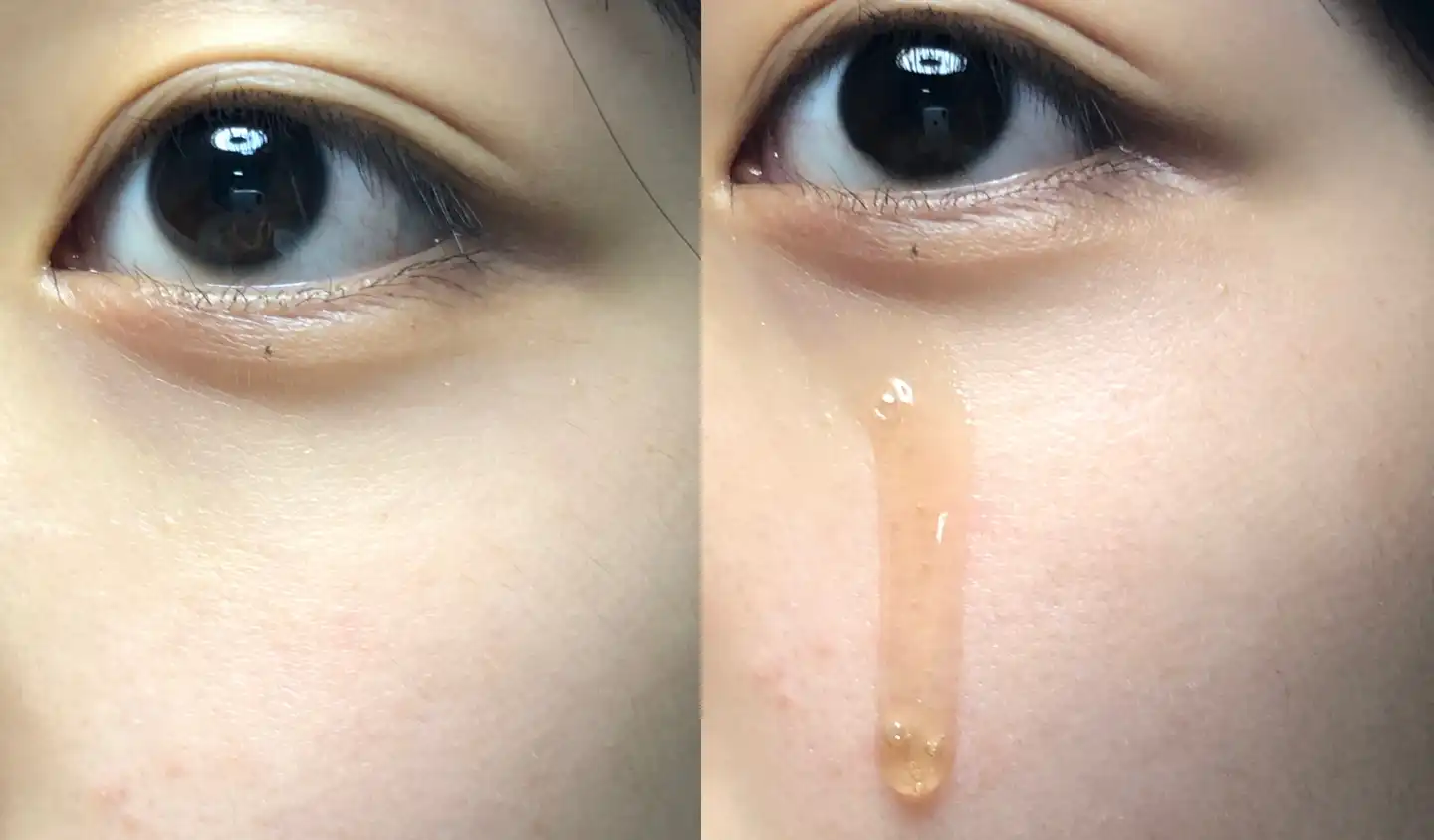 초공진 채옴 부스팅 에센스