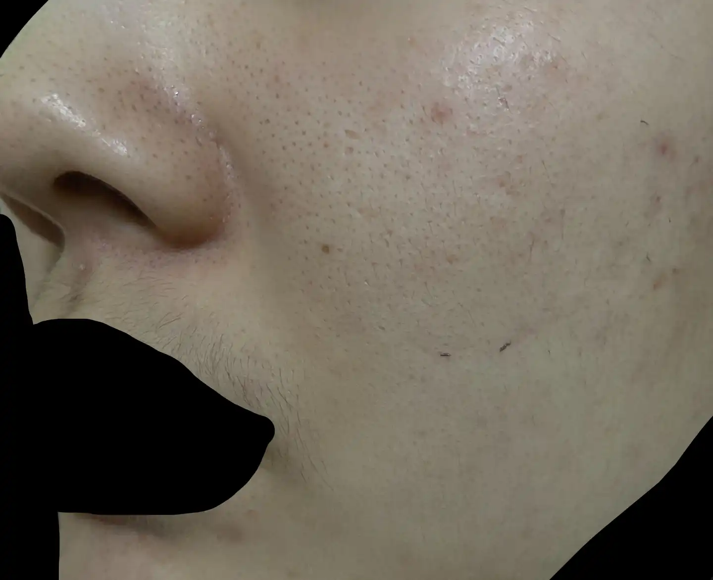 언니의파우치 리뷰 이미지 9 - [가지 클리어링 필 오프 팩]