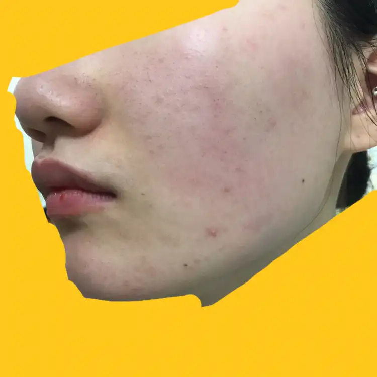 언니의파우치 리뷰 이미지 10 - [미샤 개똥쑥 진정 에센스]