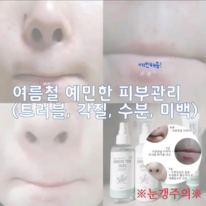  웰빙 녹차 스킨