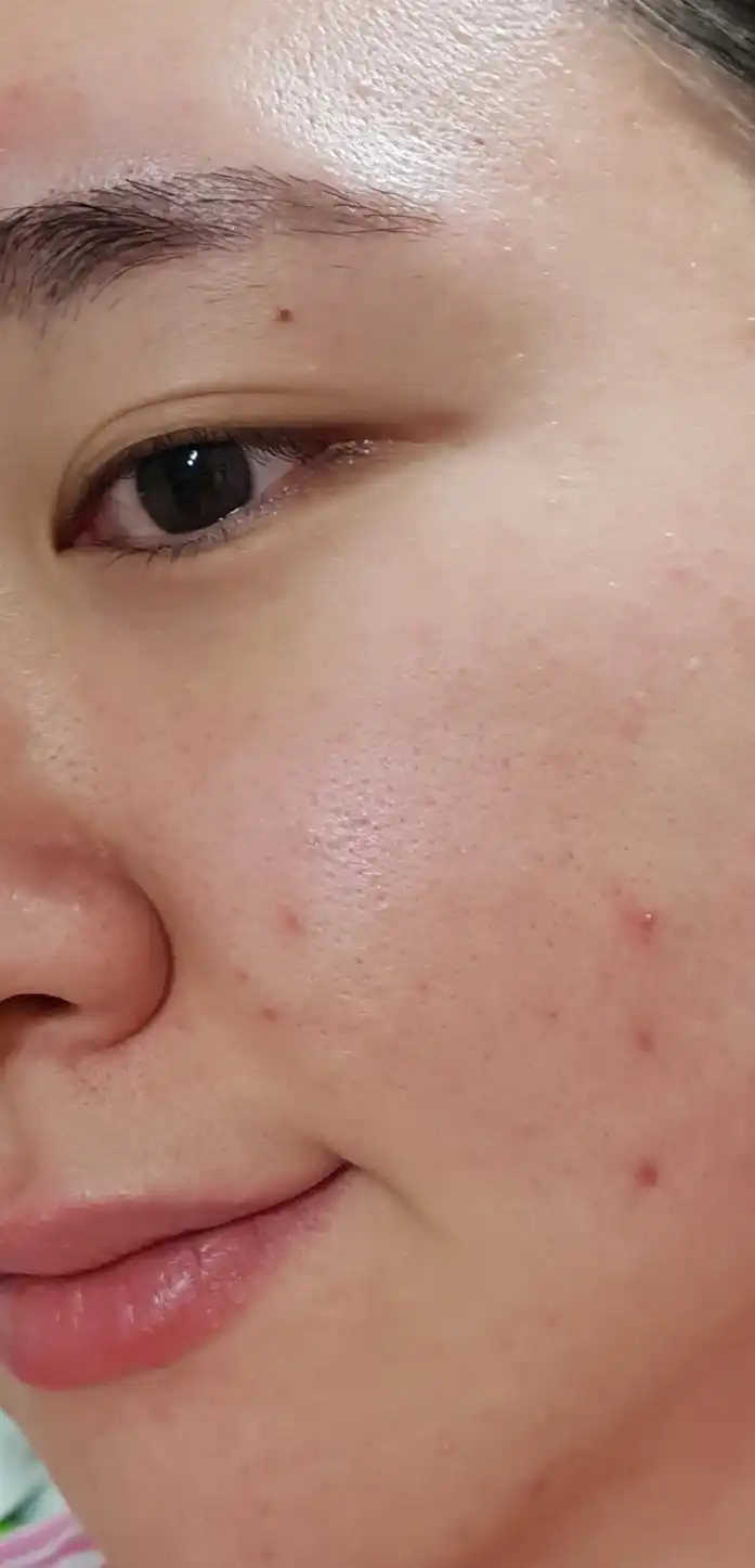 언니의파우치 리뷰 이미지 7 - [미니멀10 워터리 에센스]