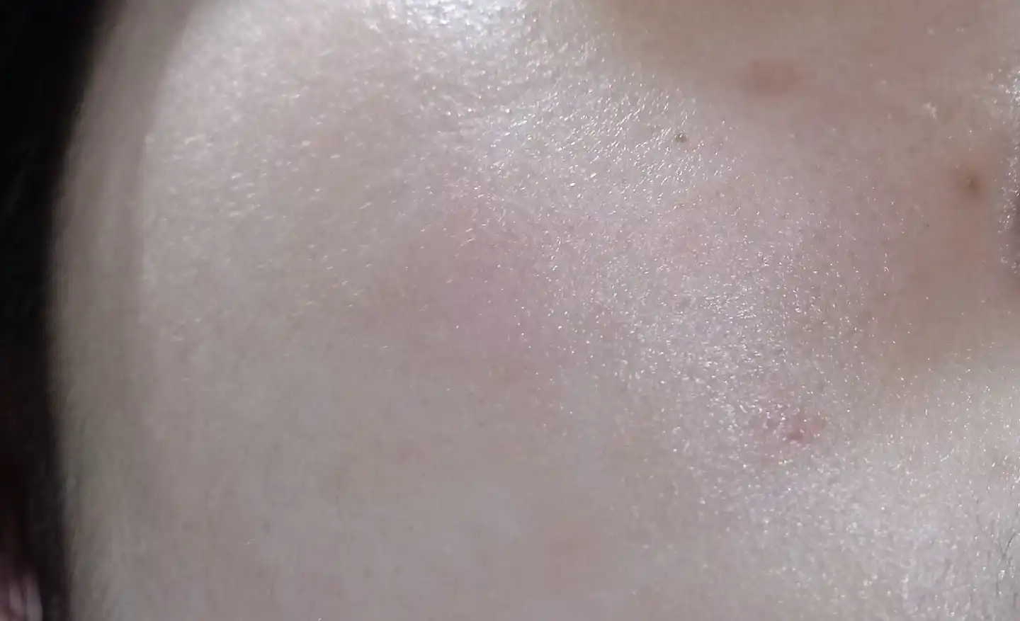 더마 플랜 센서티브 수딩 트리트먼트