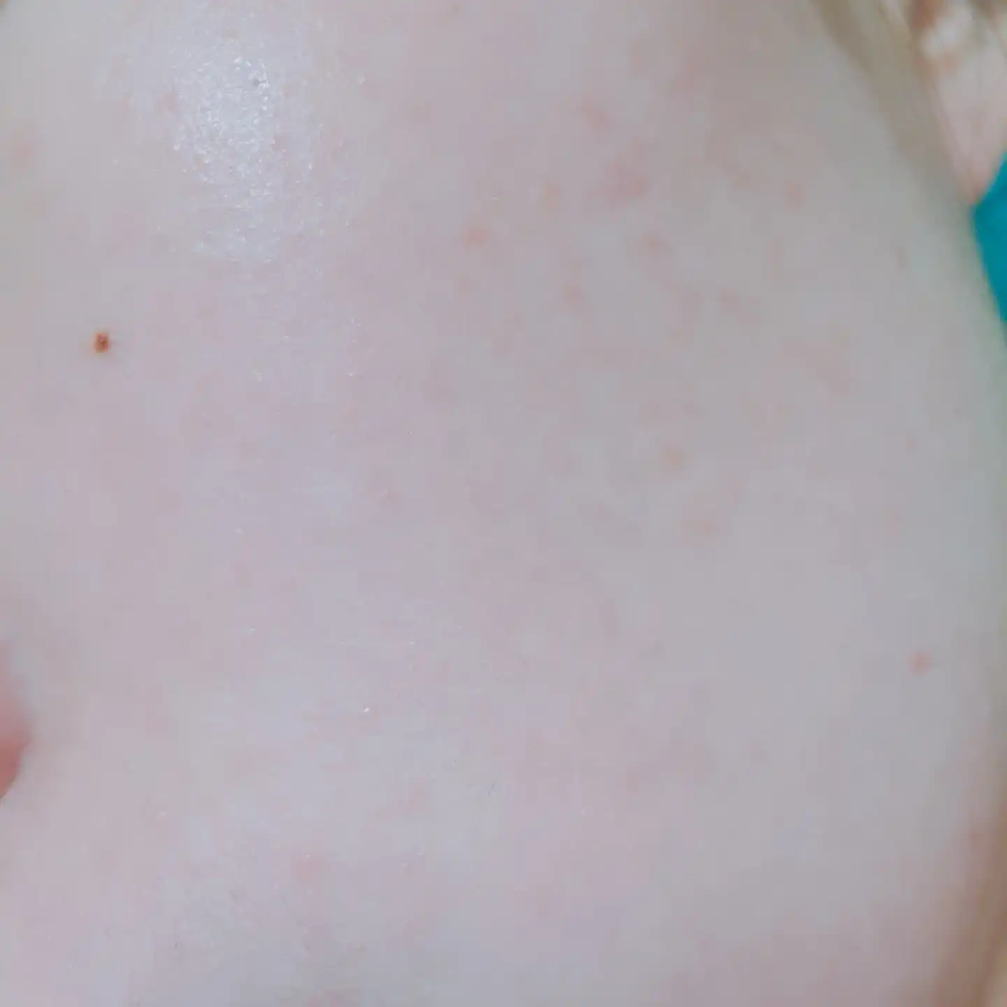 언니의파우치 리뷰 이미지 6 - [더마 플랜 수딩 베리어 앰플]