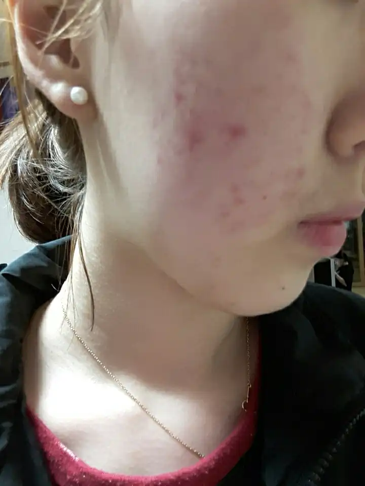 하면서마스크팩