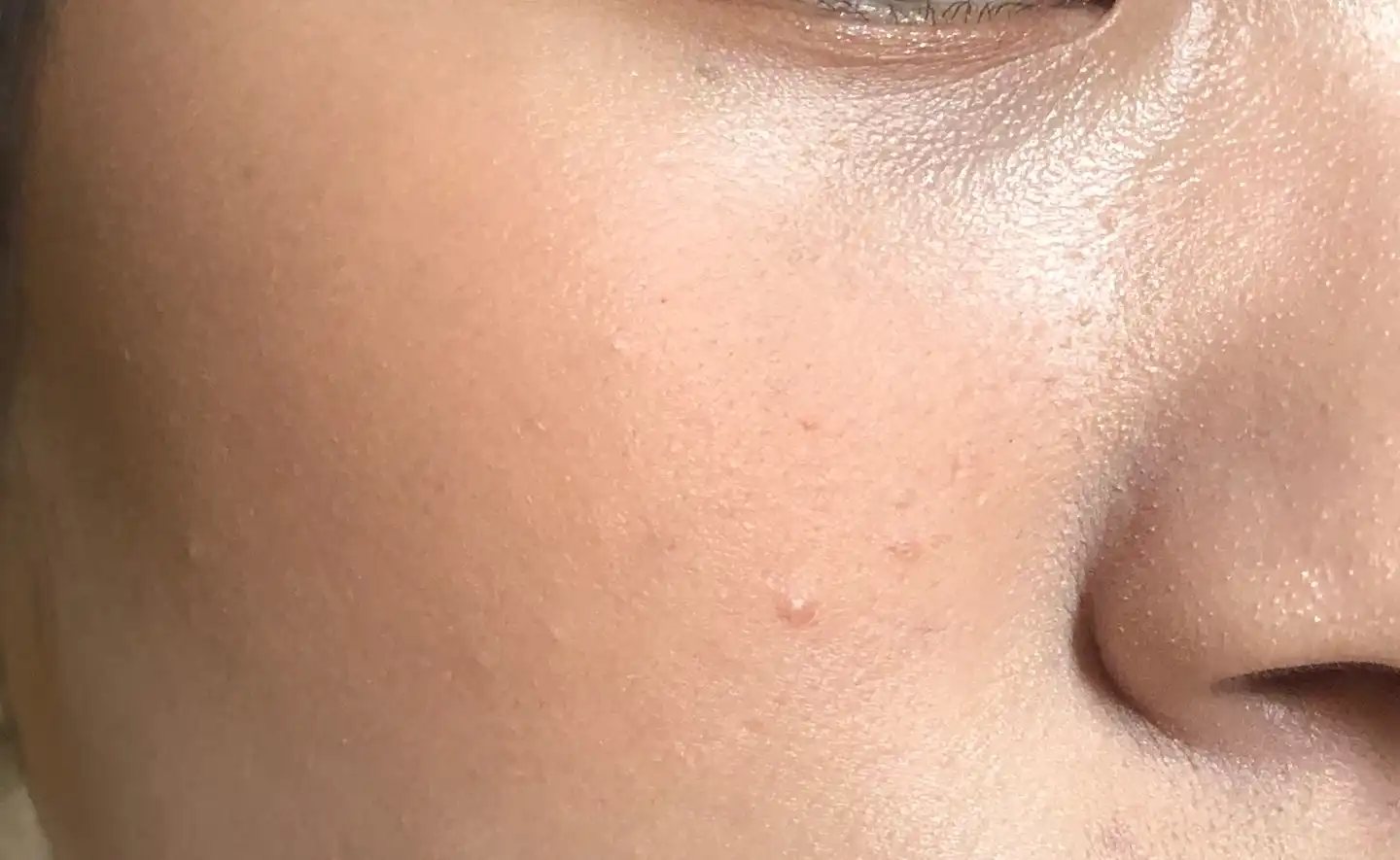 빨강머리 앤 에디션 베러 댄 치크 [01 페어칩]