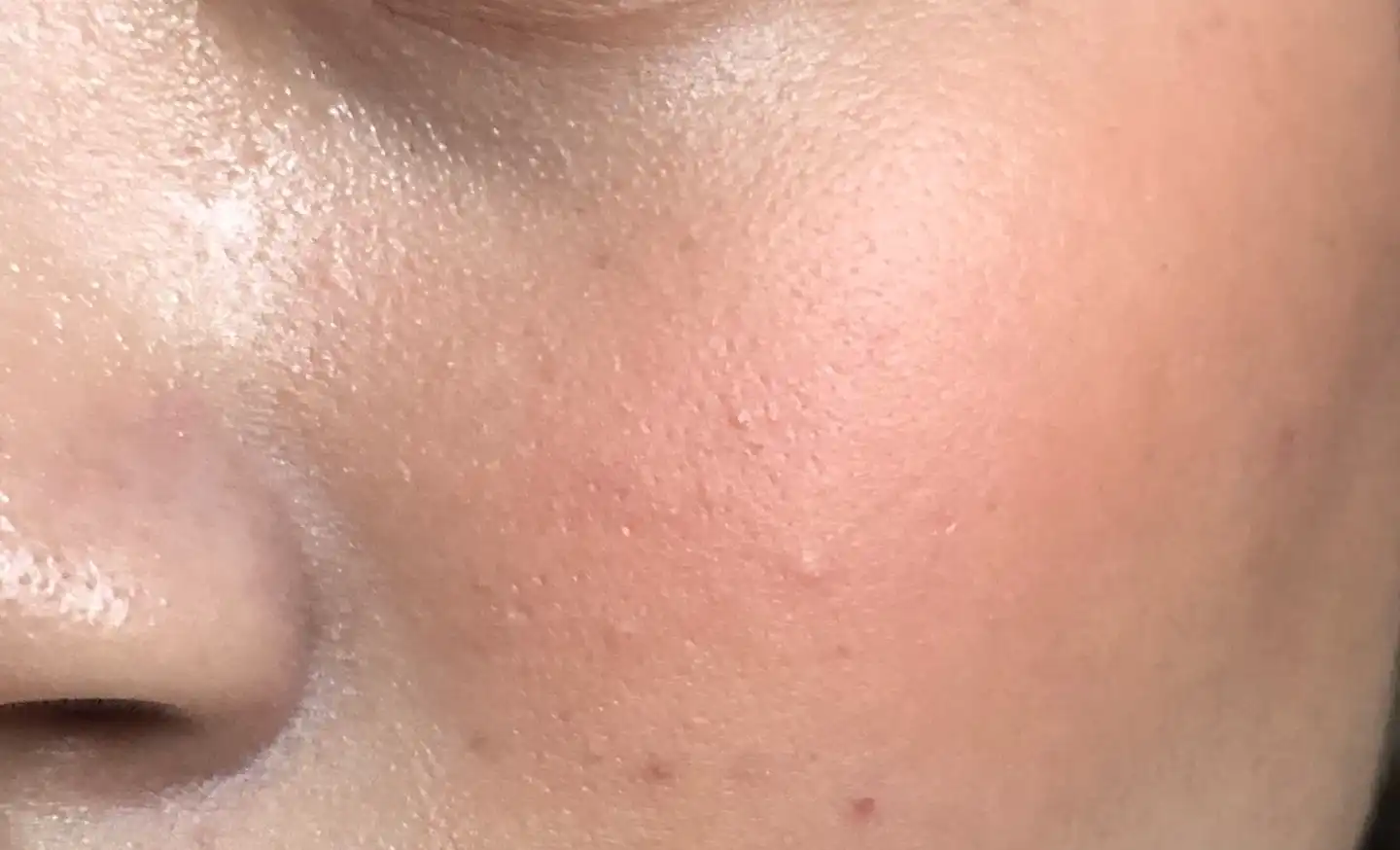 빨강머리 앤 에디션 베러 댄 치크 [02 애플칩]