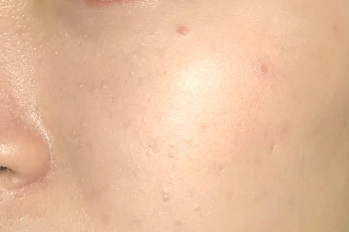 언니의파우치 리뷰 이미지 10 - [오일수 클렌징 오일]