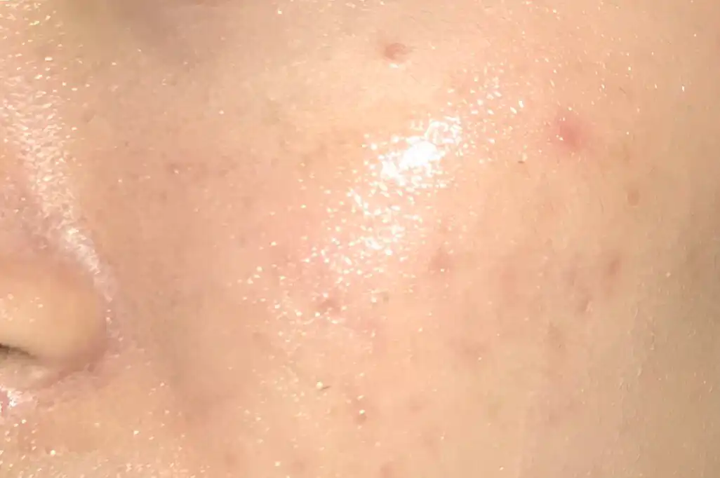 언니의파우치 리뷰 이미지 11 - [오일수 클렌징 오일]