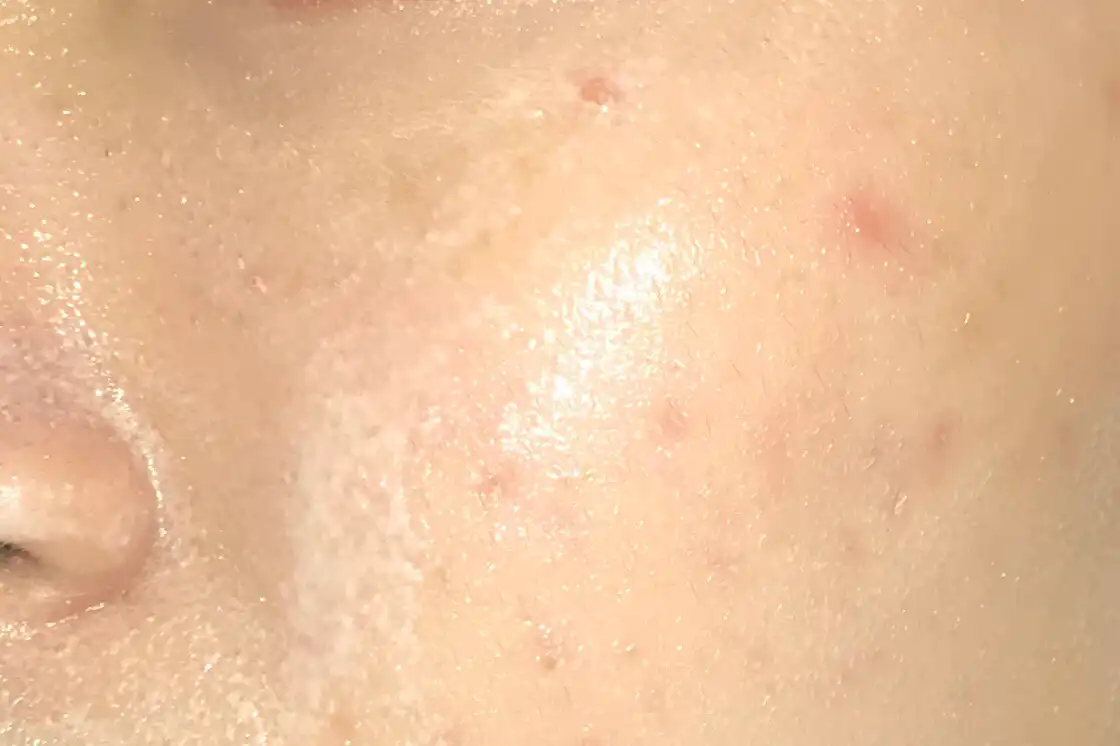 언니의파우치 리뷰 이미지 12 - [오일수 클렌징 오일]