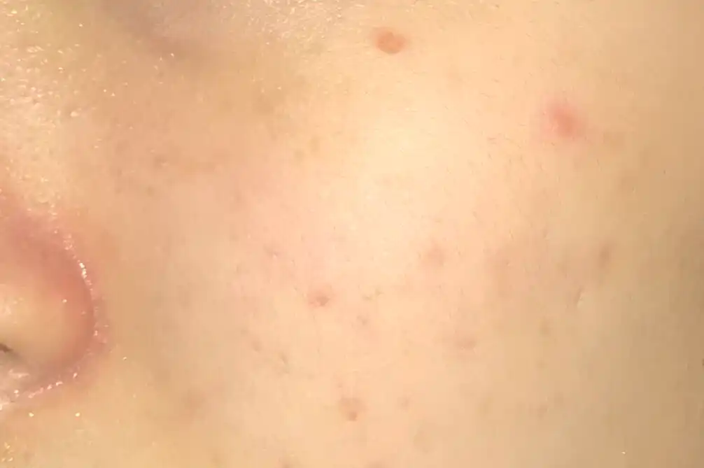 언니의파우치 리뷰 이미지 13 - [오일수 클렌징 오일]