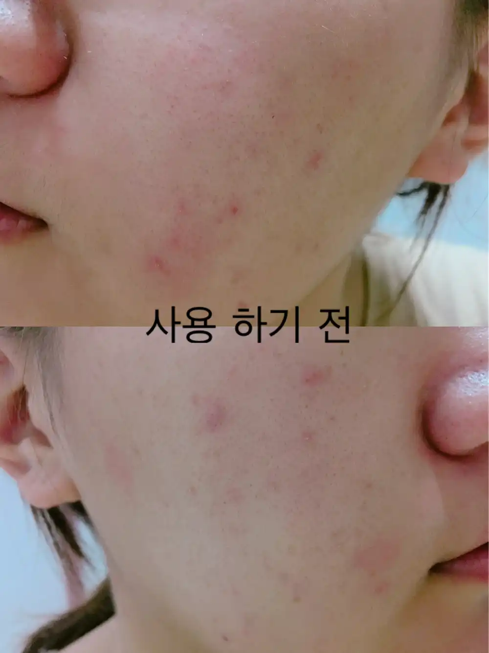 언니의파우치 리뷰 이미지 8 - [설퍼 퓨리파잉 토너 [피부진정 유황 스킨]]