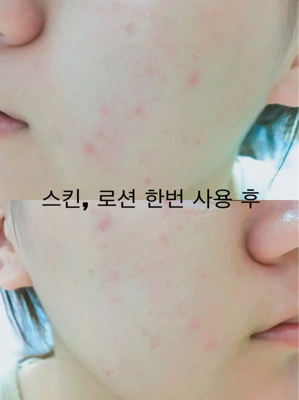 언니의파우치 리뷰 이미지 9 - [설퍼 퓨리파잉 토너 [피부진정 유황 스킨]]
