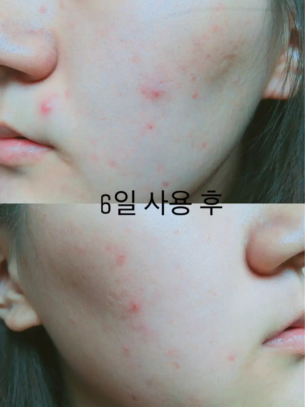 언니의파우치 리뷰 이미지 10 - [설퍼 퓨리파잉 토너 [피부진정 유황 스킨]]