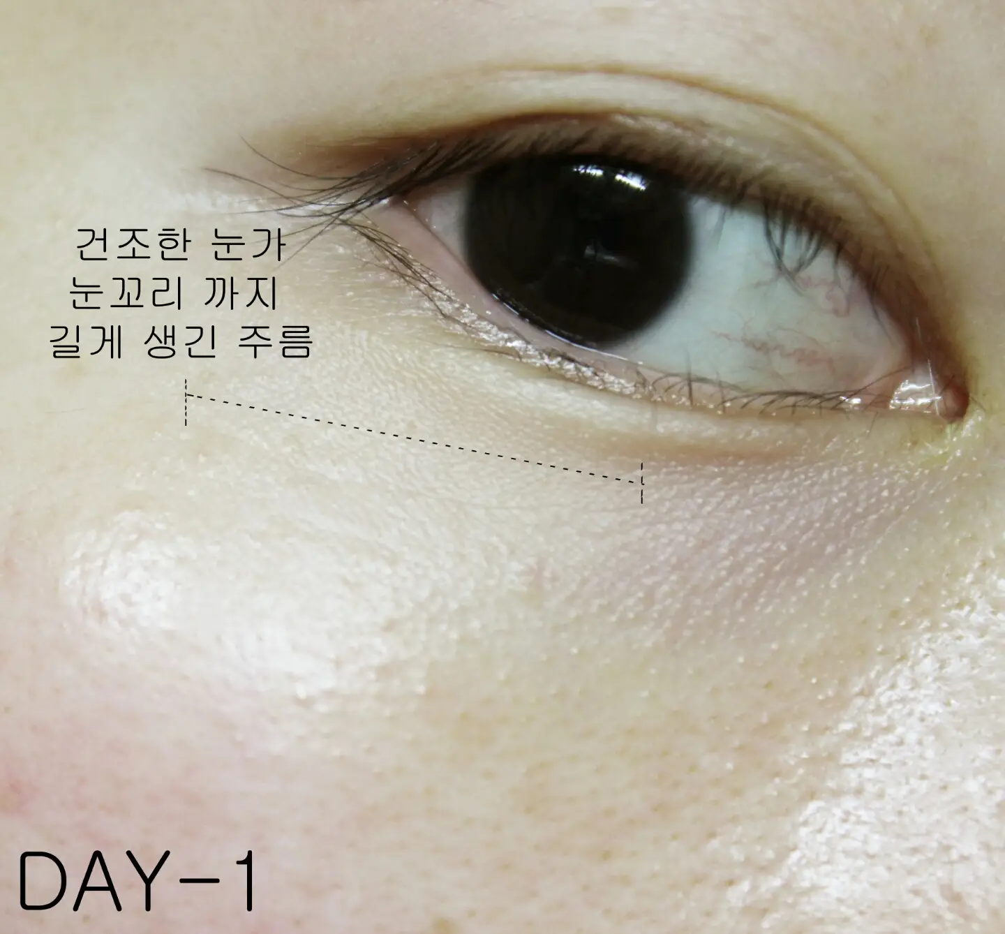 선택된 언니의파우치 리뷰 이미지 - [볼륨 리프팅 컨센트레이트]