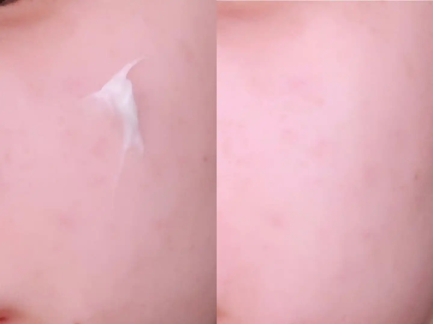 언니의파우치 리뷰 이미지 7 - [비피다 바이옴 컨센트레이트 크림]