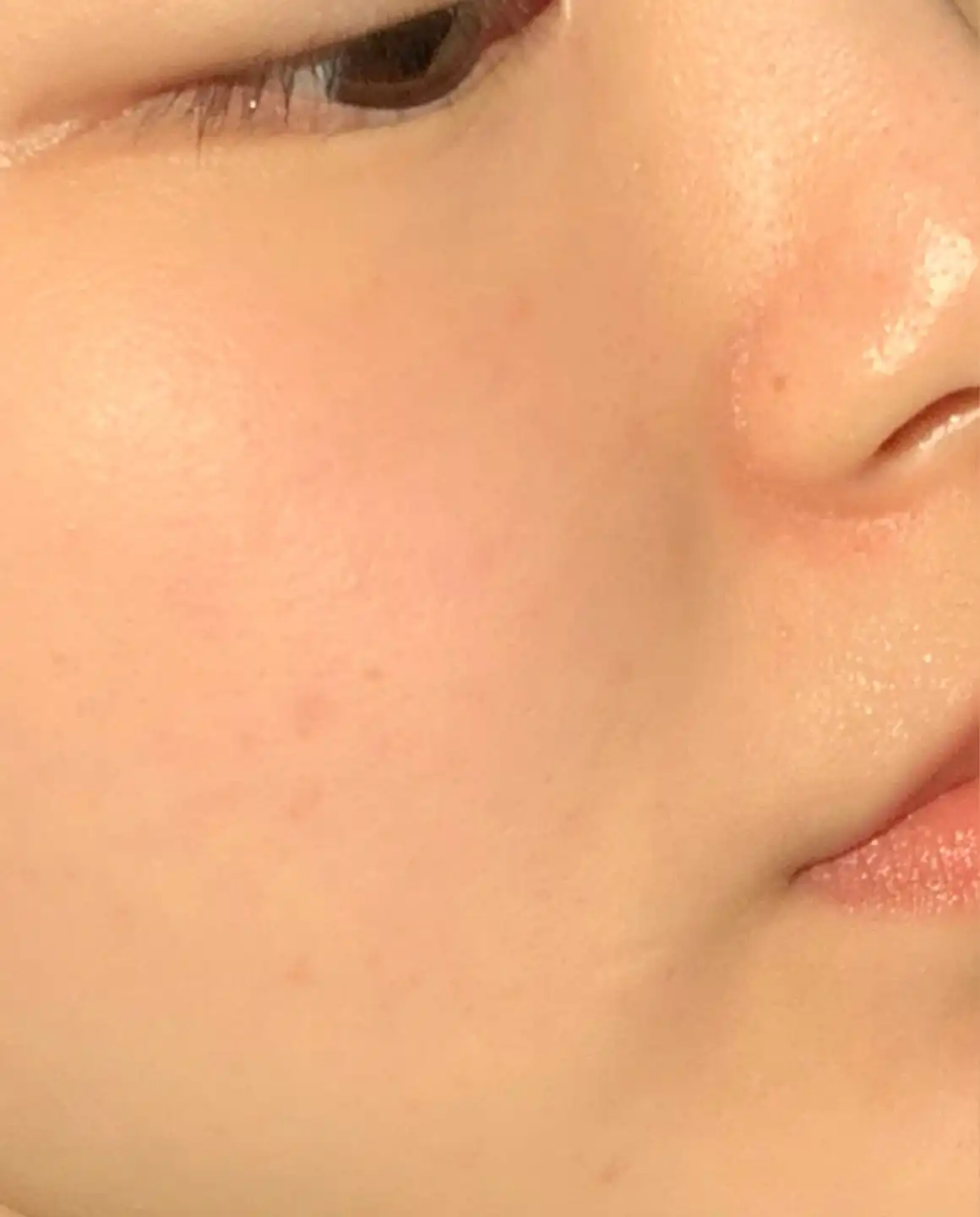 언니의파우치 리뷰 이미지 5 - [스팟 이레이저 비타 크림]