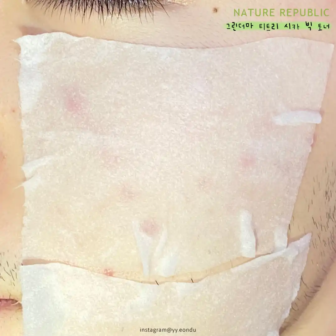 언니의파우치 리뷰 이미지 2 - [그린더마 티트리시카 토너]