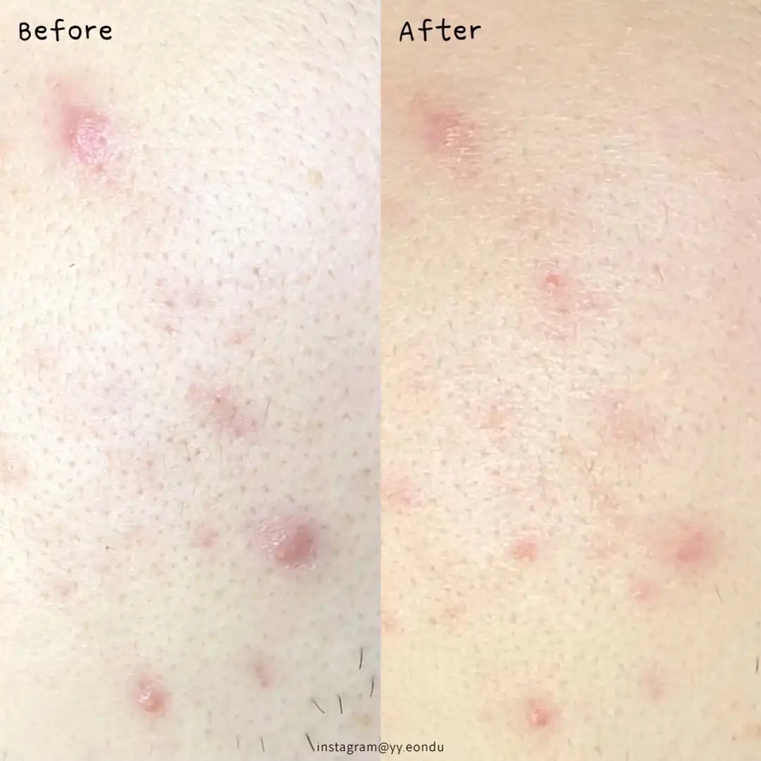 언니의파우치 리뷰 이미지 3 - [그린더마 티트리시카 토너]