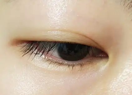 언니의파우치 리뷰 이미지 10 - [마이 래쉬 세럼 속눈썹 영양제]
