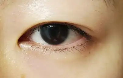 언니의파우치 리뷰 이미지 11 - [마이 래쉬 세럼 속눈썹 영양제]