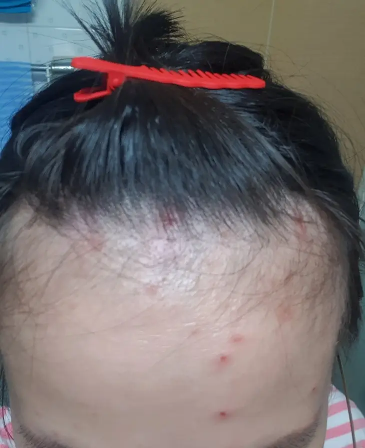 선택된 언니의파우치 리뷰 이미지 - [시카 스피디 카밍 패드[시카술톤패드]]