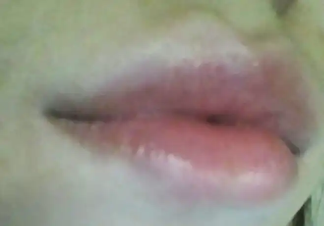 에코 꽃물 틴트밤 [봉숭아 틴트밤]