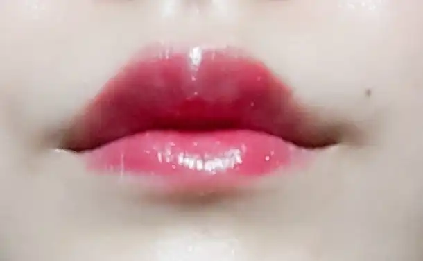 글로스 볼립떼(15)