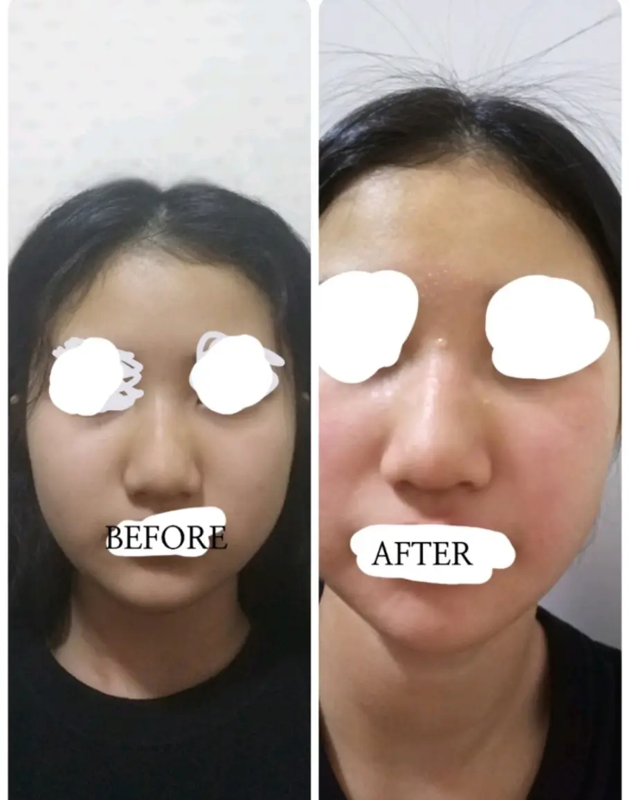 선택된 언니의파우치 리뷰 이미지 - [비타페어C 잡티 세럼]