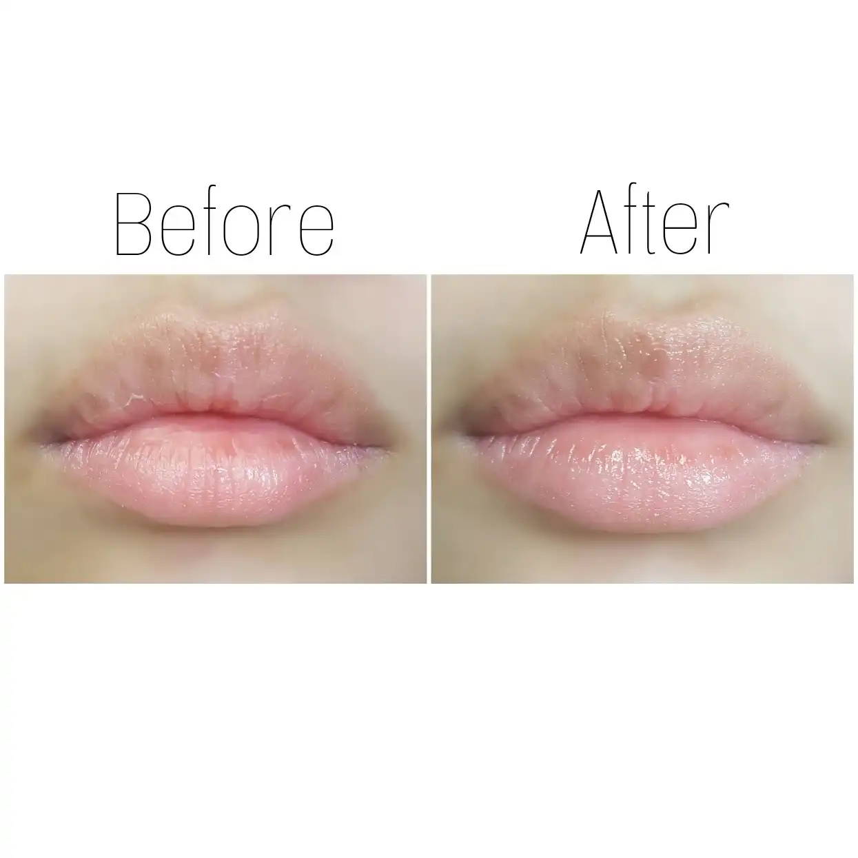 립 테라피 [알로에 베라]