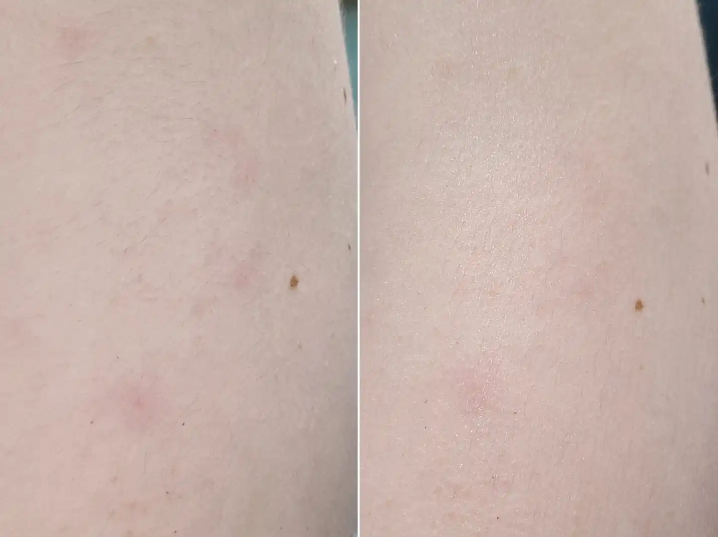 언니의파우치 리뷰 이미지 7 - [티트리 퓨리파인 80 크림]