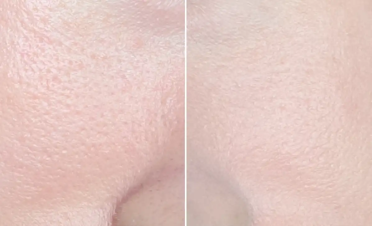 올데이 프라이머