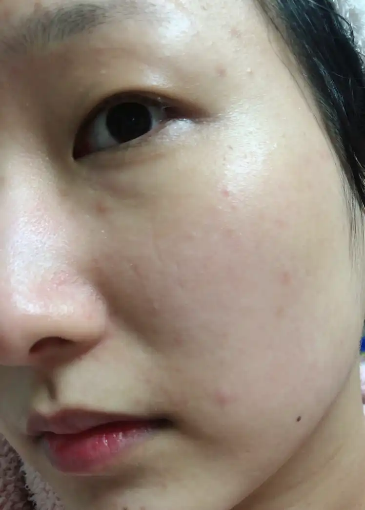 언니의파우치 리뷰 이미지 12 - [드래곤펩타이드™ 앰플 세럼]