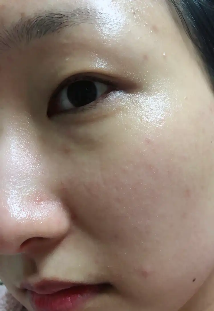 언니의파우치 리뷰 이미지 13 - [드래곤펩타이드™ 앰플 세럼]