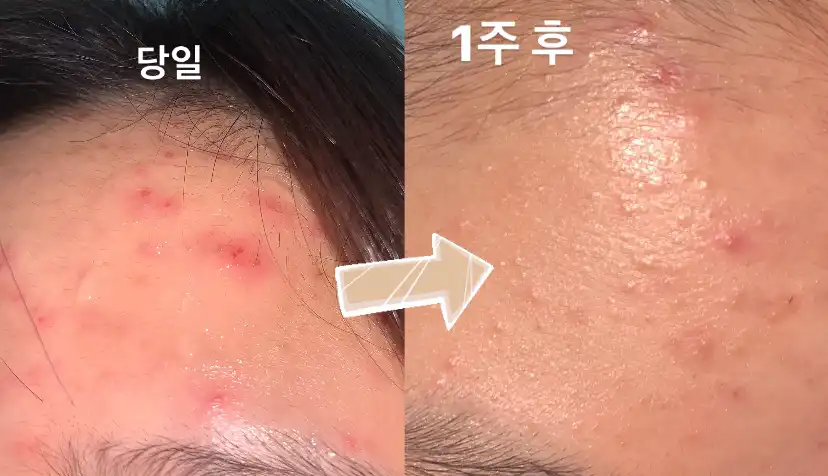 리뷰 이미지