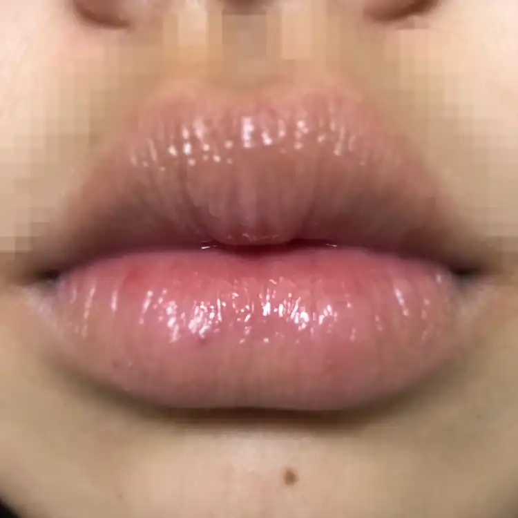 부비부비 립 앰플