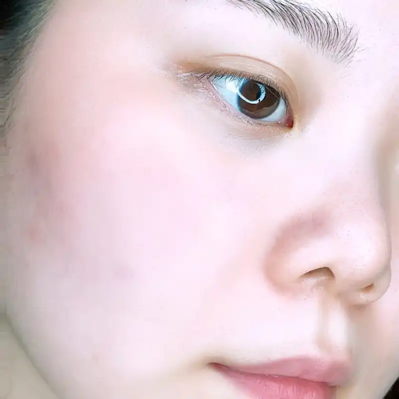 언니의파우치 리뷰 이미지 3 - [스케일링 토너 [중건성]]