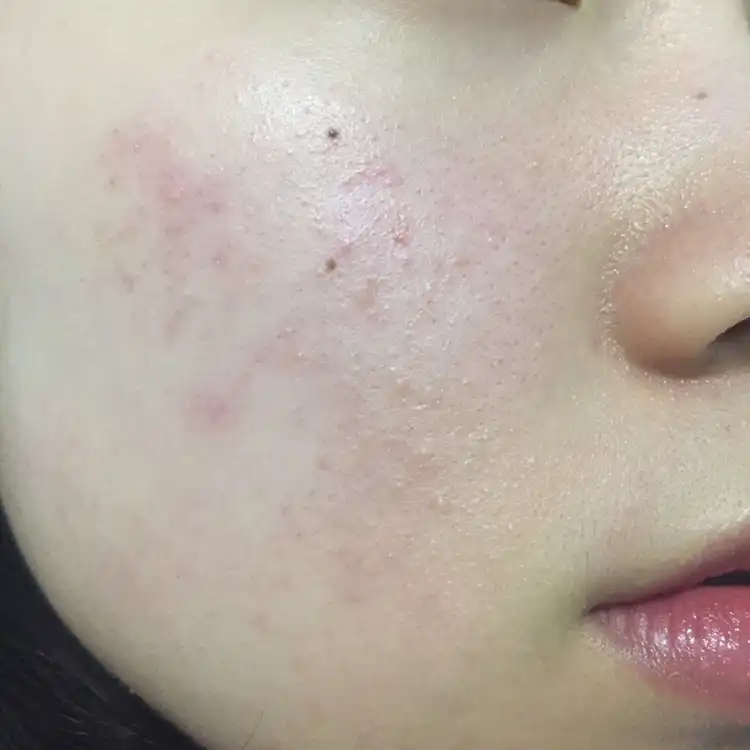 언니의파우치 리뷰 이미지 7 - [퍼펙트 유브이 프로텍션 크림 롱래스팅 [지복합성피부용]]