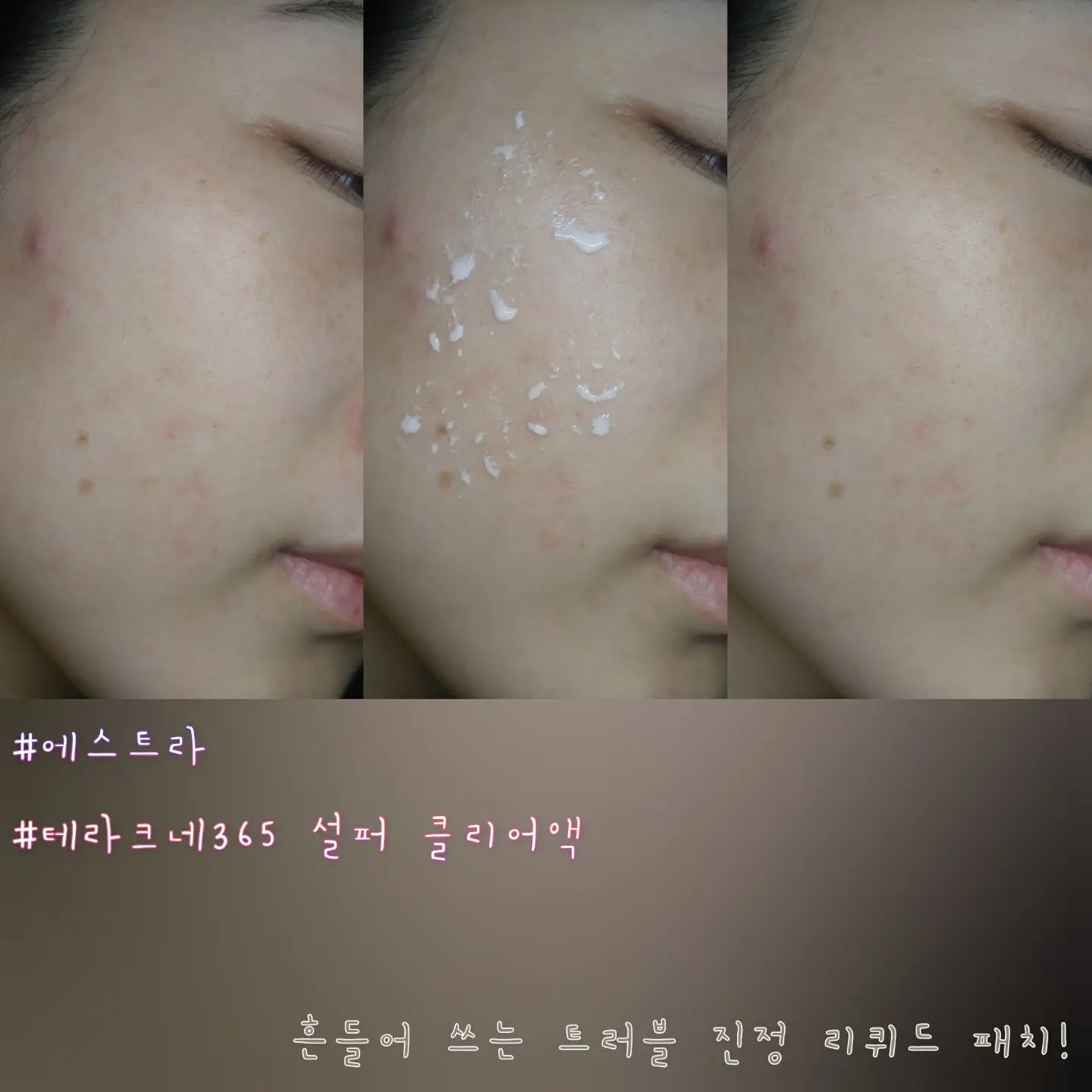 선택된 언니의파우치 리뷰 이미지 - [테라크네 365 설퍼 클리어액]