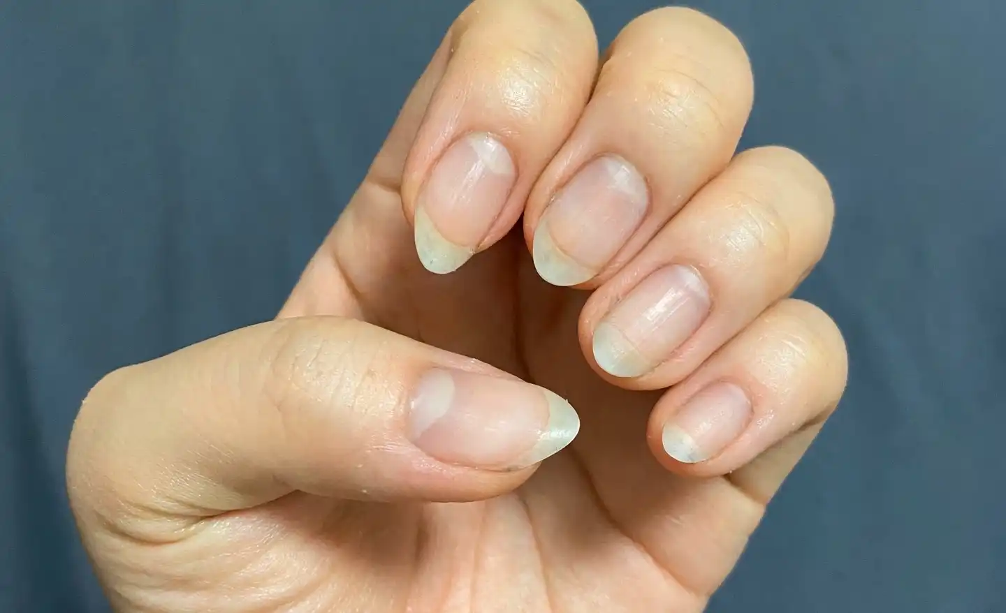 네일 케어 패치