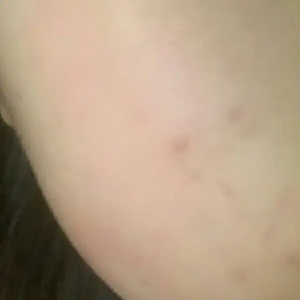 언니의파우치 리뷰 이미지 3 - [비자 트러블 스킨]