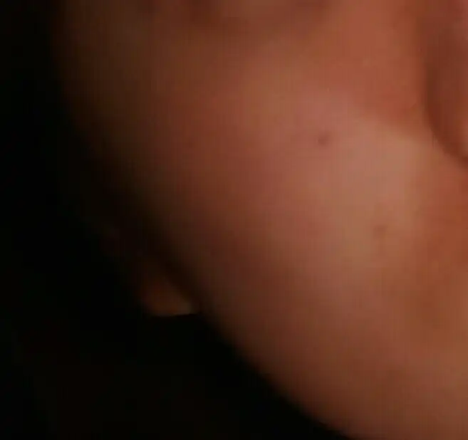 언니의파우치 리뷰 이미지 4 - [비자 트러블 스킨]