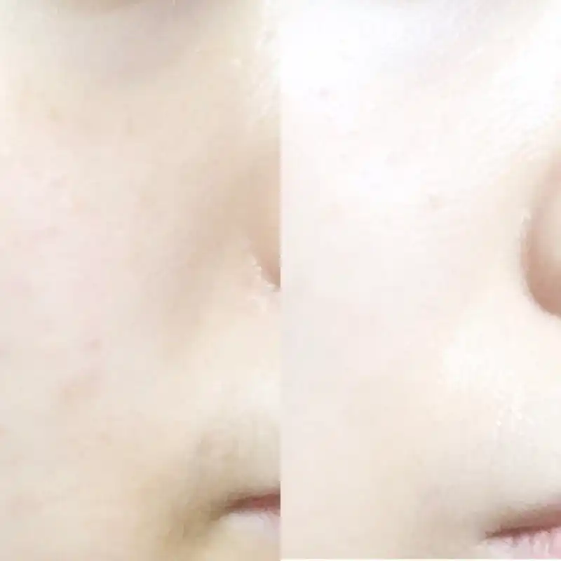 언니의파우치 리뷰 이미지 5 - [데이지 에센스]